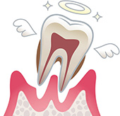 歯周病の進行段階5
